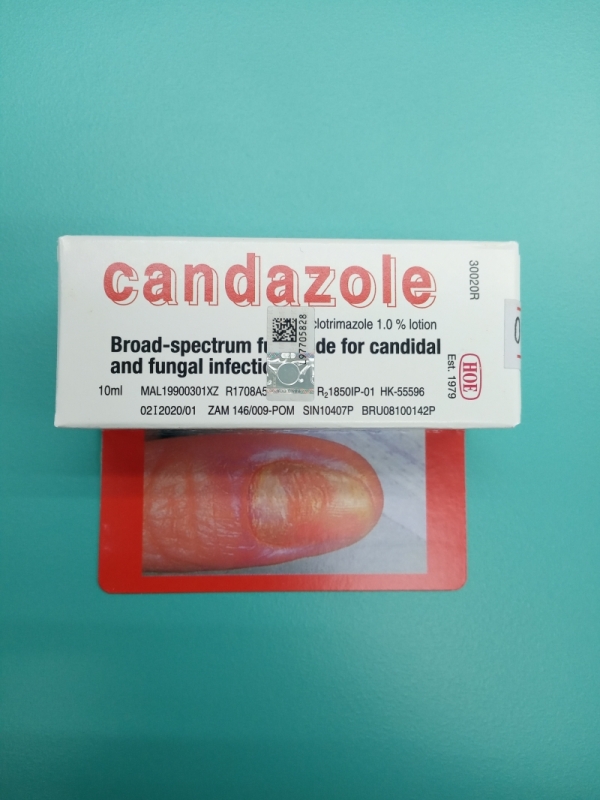 Candazole Lotion Antifungal
