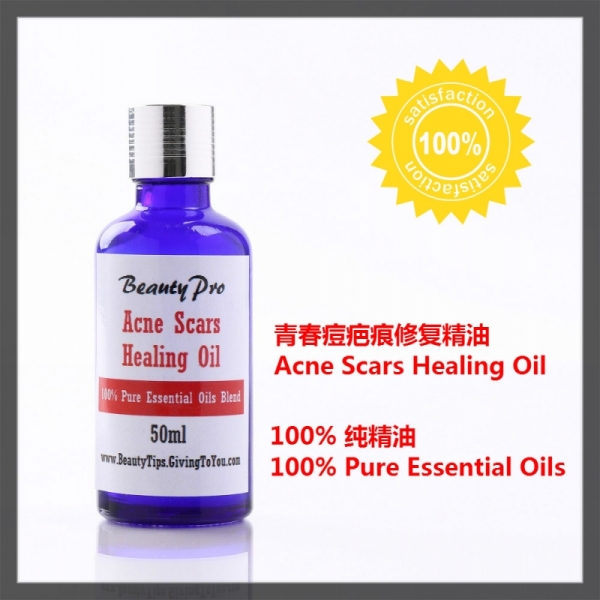 Acne Scars Healing Essential Oils - 50ml - Treat Open Pores Blemishes Redness Pimples Damage Skin