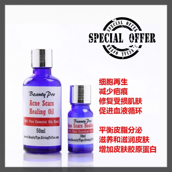 Acne Scars Healing Essential Oils - 50ml - Treat Open Pores Blemishes Redness Pimples Damage Skin