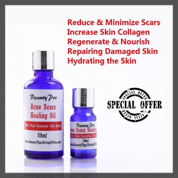 Acne Scars Healing Essential Oils - 10ml - Treat Open Pores Blemishes Redness Pimples Damage Skin