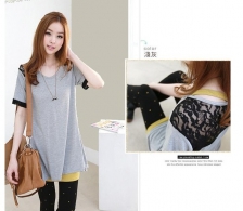 Trendy Lace Design Casual Top
